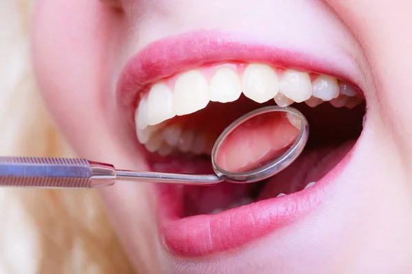 Οδοντιατρική Περίθαλψη Κοντινό Πλάνο Νεαρή Γυναίκα Έχει Δόντια Της Εξετάζονται — Φωτογραφία Αρχείου