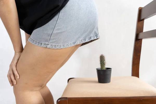 Women Ass Sits Cactus Conceptual Image Hemorrhoid Other Diseases Side — Zdjęcie stockowe