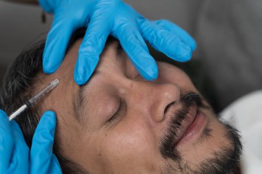 Kapalı gözlerle rahatça uzanan orta yaşlı adama yakın. Eldiven giyen doktordan alnına botoks iğnesi yiyene kadar. Kozmetik prosedür kavramı, kırışıklık azaltma, yaşlanmayı önleyen güzellik bakımı..