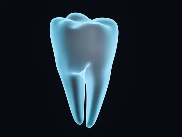 Dental Implant Dentist Tooth Layout Plastics Man Teeth Treatment Rendering — Stock Photo, Image