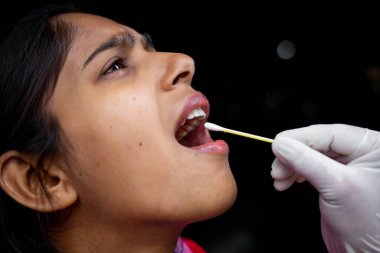 Doktorun eli, genç bayanın ağzından pamuklu çubukla tükürük testi alıyor. Coronavirus Gırtlak Koleksiyonu. Yakın plan görüntüler.