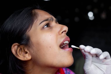 Doktorun eli, genç bayanın ağzından pamuklu çubukla tükürük testi alıyor. Coronavirus Gırtlak Koleksiyonu. Yakın plan görüntüler.