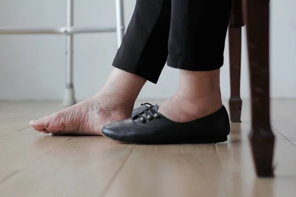 Femme Âgée Pieds Gonflés Mettre Des Chaussures — Photo