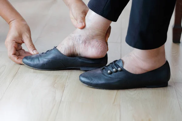 Starsza Kobieta Opuchnięte Nogi Zakładanie Butów Dawcą Opieki — Zdjęcie stockowe