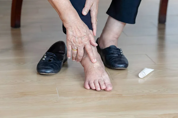 靴を履く前に腫れた足にクリームを置く高齢女性 — ストック写真