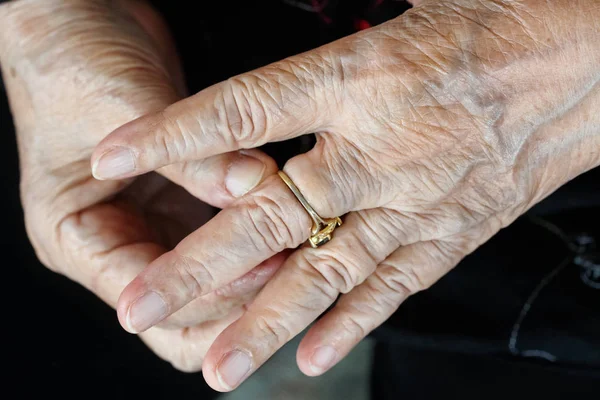 Starší Žena Snaží Odstranit Zablokované Kroužek Oteklý Prst — Stock fotografie