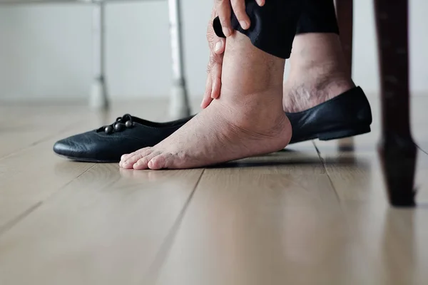 Пожилая Женщина Опухшие Ноги Надевая Обувь — стоковое фото