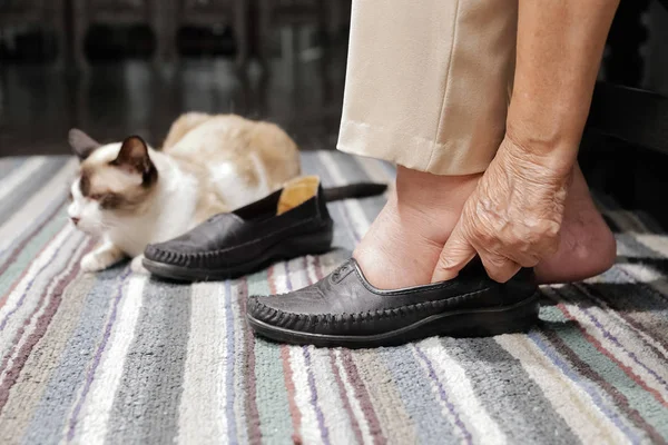 Elderly woman swollen feet putting on shoes