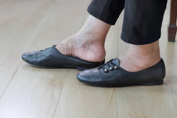 Bejaarde Vrouw Schoenen Zetten — Stockfoto