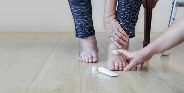 Starsza Kobieta Wprowadzenie Krem Opuchnięte Nogi — Zdjęcie stockowe
