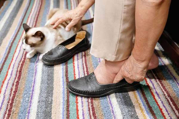 Ältere Frau geschwollene Füße, die Schuhe anziehen — Stockfoto