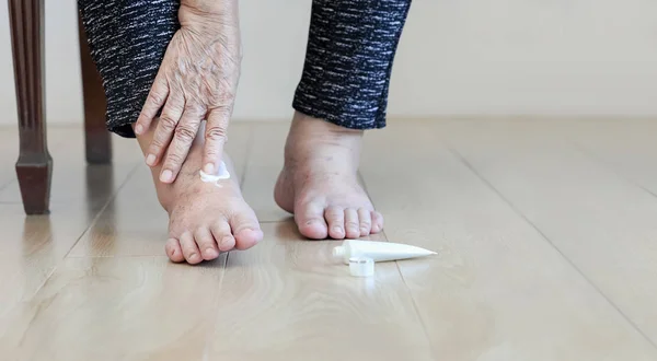 Elderly woman putting cream on swollen feet — Stock Photo, Image