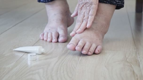 Mujer Mayor Poniendo Crema Los Pies Hinchados — Vídeo de stock