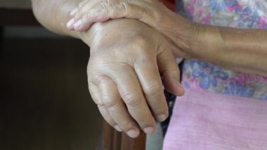 Yaşlı şişmiş el veya ödem el