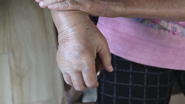 Elderly Swollen Hand Edema Hand — Stock Video