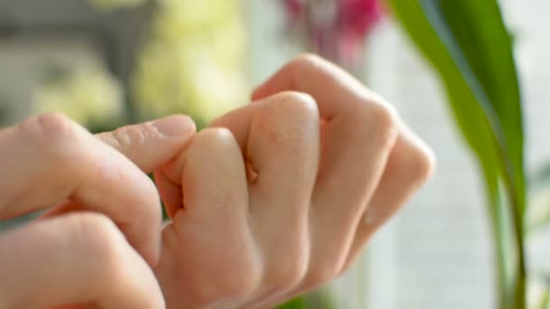 Zbliżenie mężczyzna nastolatek palce stosując balsam do swędzenie, drażniący skóry — Wideo stockowe