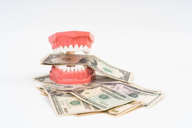 Abd Doları ile Diş Modeli