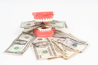 Abd Doları ile Diş Modeli