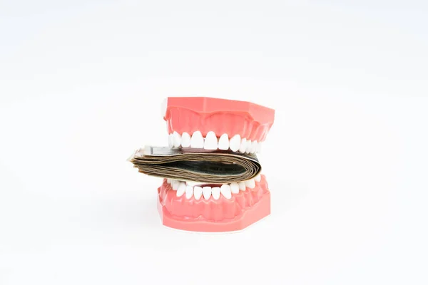 Dental model with US dollar — Stock Photo, Image