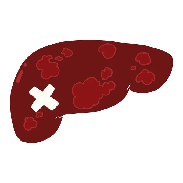 Flat Color Style Cartoon Unhealthy Liver — Stock Vector