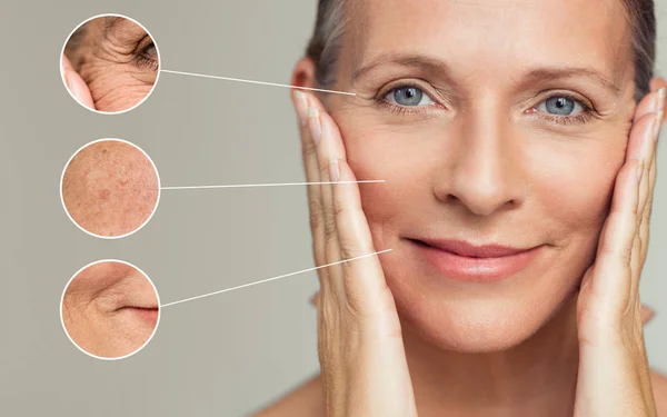 しわのクローズ アップと 年配の女性の表面欠陥を皮膚します 美容治療後彼女の完璧な肌に触れる美しい年配の女性の肖像画 老化プロセスの概念 — ストック写真