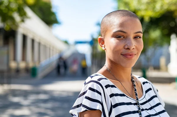 Calvo orgoglioso ragazza alla moda — Foto Stock