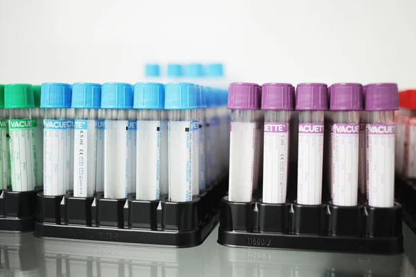 Medical test tubes with colored caps for various tests of blood and other liquids