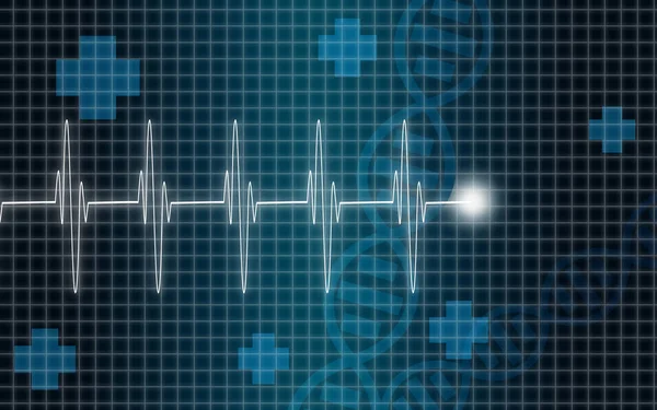 Illustration of heart machine display