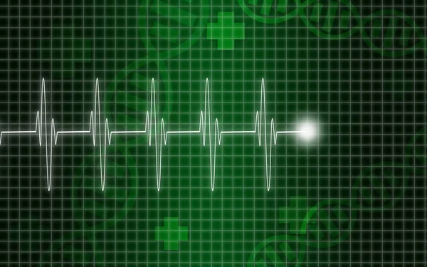 Cardiogram on the green screen — Stock Photo, Image