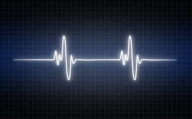Elektrokardiyogram grafiği, monitörde gösterilen kalp atışı