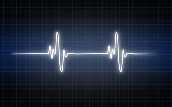 Gráfico de electrocardiograma, latidos cardíacos mostrados en monitor —  Fotos de Stock