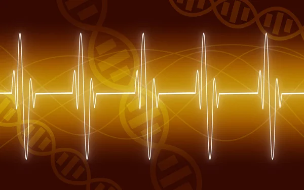 Illustration of EKG trace on yellow background