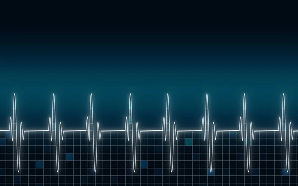 Cardiogramme cardiaque avec fond bleu — Photo