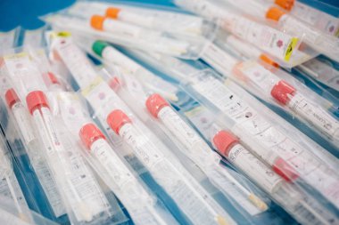 Fryazino, Rusya - 06 11 2018: konteynerler alarak biyolojik malzeme mavi arka plan, steril paket üzerinde. Tıbbi araştırmalar için konular