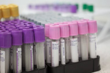 Fryazino, Rusya - 06 11 2018: çok renkli tüpler için kan, Tıbbi maddeler, biomaterial toplama, office kavramı