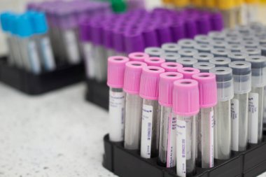 Fryazino, Rusya - 06 11 2018: çok renkli tüpler için kan, Tıbbi maddeler, biomaterial toplama, office kavramı