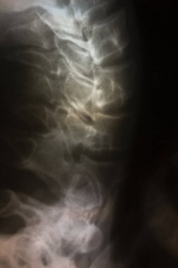 insan vücudunun parçaları, x-ışını resim, roentgen x-ışını görüntü