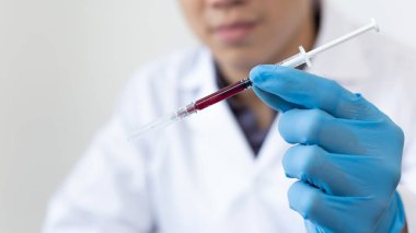 Bilim insanları veya doktorlar, virüs konseptini ortadan kaldırmak için araştırma laboratuvarında analiz ve aşı için yeni virüs türlerinden kan örnekleri topluyorlar..