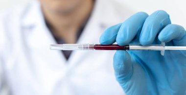 Bilim insanları veya doktorlar, virüs konseptini ortadan kaldırmak için araştırma laboratuvarında analiz ve aşı için yeni virüs türlerinden kan örnekleri topluyorlar..