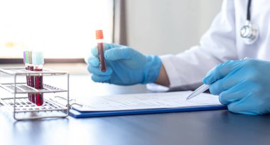 Bilim insanları ya da hekimler, yeni bir virüs türü olan Aşı Araştırma ve Bilim Konseptine karşı aşı hazırlamak için tüp bebek kan örneğini analiz ediyor..