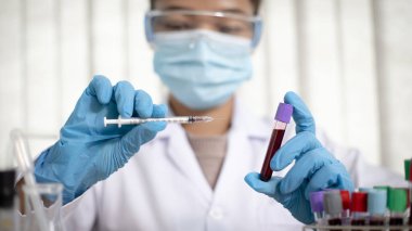 Bilim insanları antibiyotikleri normal tedavi için analiz etmek, antiretroviral ilaçlar veya patojenler konseptini test etmek için enfekte olmuş hastaların kanındaki antiretroviral ilaçları test ediyorlar..