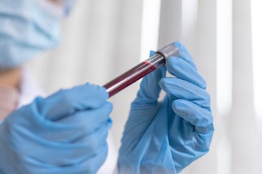 Bilim insanları antibiyotikleri normal tedavi için analiz etmek, antiretroviral ilaçlar veya patojenler konseptini test etmek için enfekte olmuş hastaların kanındaki antiretroviral ilaçları test ediyorlar..