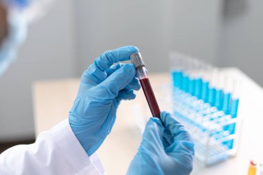 Bilim insanları antibiyotikleri normal tedavi için analiz etmek, antiretroviral ilaçlar veya patojenler konseptini test etmek için enfekte olmuş hastaların kanındaki antiretroviral ilaçları test ediyorlar..