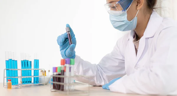Forskare Testar Antiretrovirala Läkemedel Från Blodet Hos Infekterade Patienter För — Stockfoto