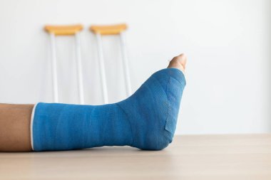 Genç bir adamın düştüğü kazadan bacağında mavi bilek ve ayak bantları, ayak bileğinde mavi alçı, koltuk değnekleri hastanın yürümesine yardımcı oluyor..