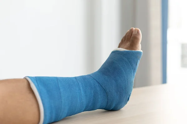 一个年轻人摔倒时腿上的蓝色脚踝和脚夹板绷带 脚踝上的蓝色石膏 — 图库照片