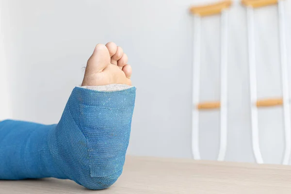 Blue Ankle Foot Splint Bandages Legs Young Man Fall Accident — Stock Photo, Image