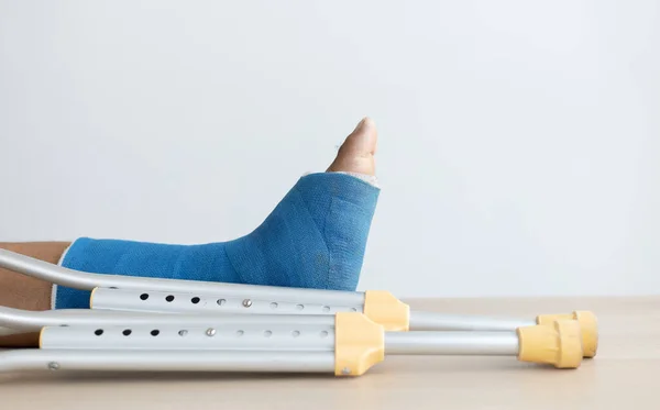 Blue ankle and foot splint Bandages on the legs from a young man\'s fall accident, Blue plaster on the ankle, Crutches assist in the walking of the patient.