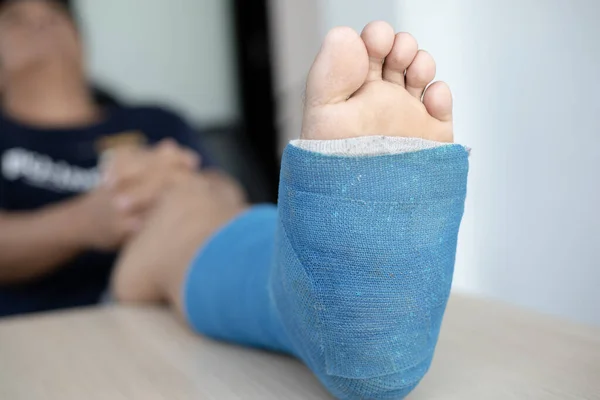 Blue ankle and foot splint Bandages on the legs from a young man's fall accident, Blue plaster on the ankle.