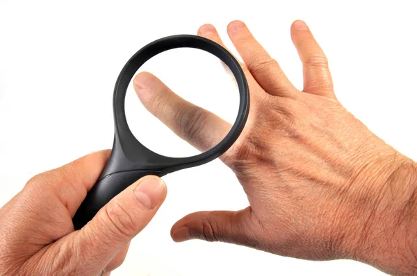 Dermatologisk Undersökning Hand Med Förstoringsglas Närbild Vit Bakgrund — Stockfoto